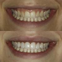 Meng Dentistry image 10